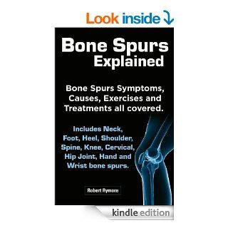 Bone Spurs explained. Bone Spurs Symptoms, Causes, Exercises and Treatments all covered. Includes Neck, Foot, Heel, Shoulder, Spine, Knee, Cervical, Hip Joint, Hand and Wrist bone spurs. eBook: Robert Rymore: Kindle Store
