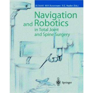 Navigation and Robotics in Total Joint and Spine Surgery: James B. Stiehl, Werner H. Konermann, Rolf G. Haaker: 9783540029342: Books