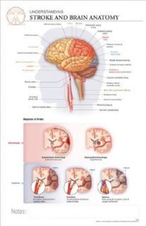 11 x 17 Post It Disease Chart: STROKE & Brain Anatomy: Science Lab Education Curriculum Support: Industrial & Scientific