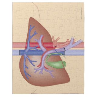 Liver Transplant Procedure Puzzles