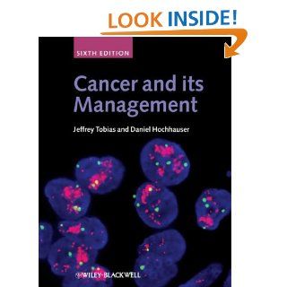 Cancer and its Management (9781405170154): Jeffrey S. Tobias, Daniel Hochhauser: Books