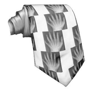 Polydactyly, Six Fingered Hand, X Ray, rarity! Neck Tie