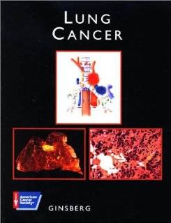 Lung Cancer with CDROM (American Cancer Society Atlas of Clinical Oncology): Robert J. Ginsberg: 0001550090992: Books