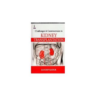 Challenges and Controversies in Kidney T (Hardcover)